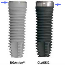 implante dental titanio